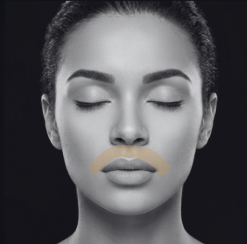 Bigote